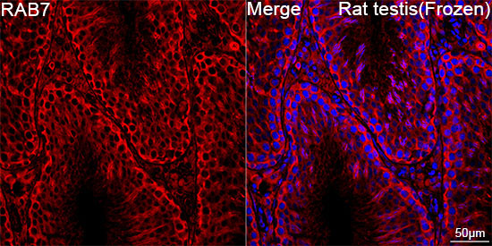 RAB7 Rabbit Monoclonal Antibody - Image 5