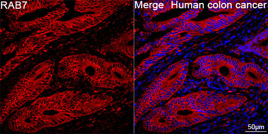 RAB7 Rabbit Monoclonal Antibody - Image 6