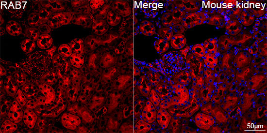 RAB7 Rabbit Monoclonal Antibody - Image 7