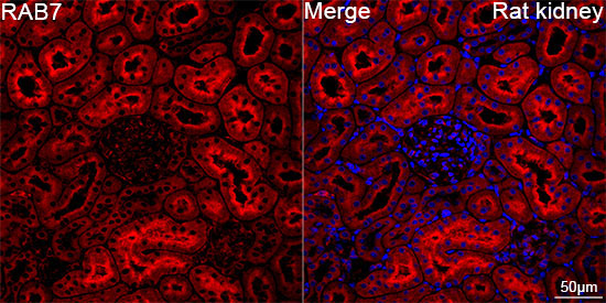 RAB7 Rabbit Monoclonal Antibody - Image 8