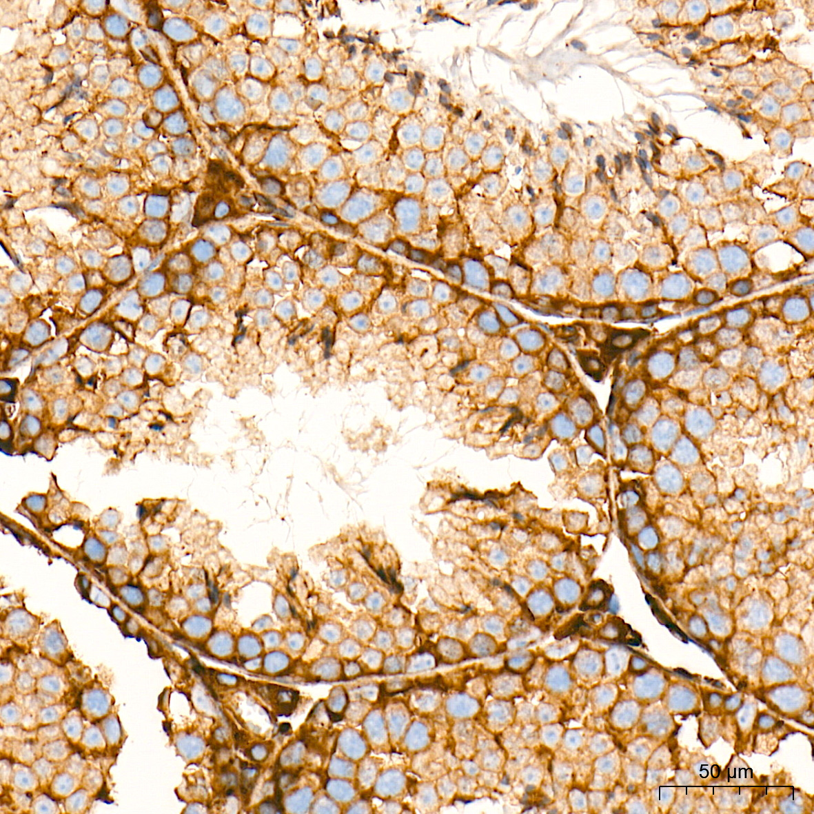RAB7 Rabbit Monoclonal Antibody - Image 11