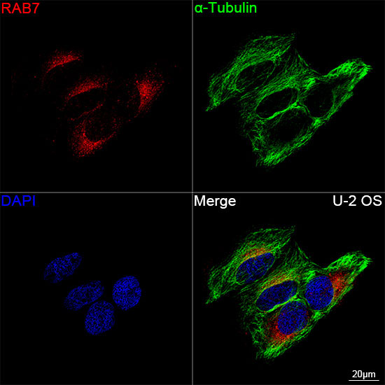 RAB7 Rabbit Monoclonal Antibody - Image 13