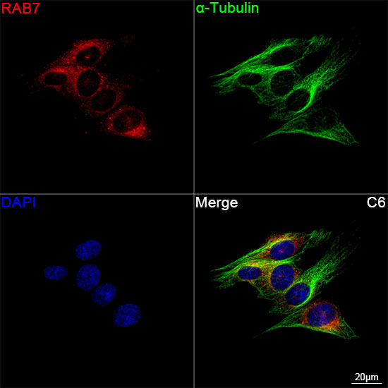 RAB7 Rabbit Monoclonal Antibody - Image 15