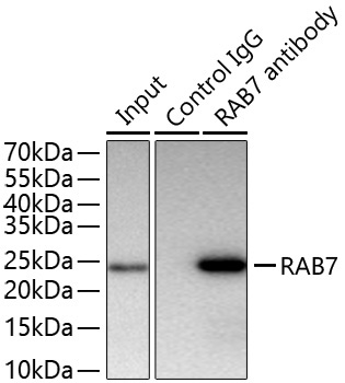 RAB7 Rabbit Monoclonal Antibody - Image 16