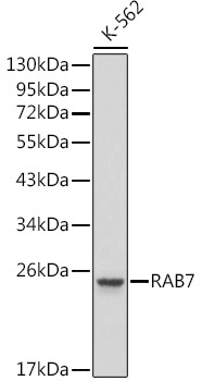 RAB7 Rabbit Polyclonal Antibody