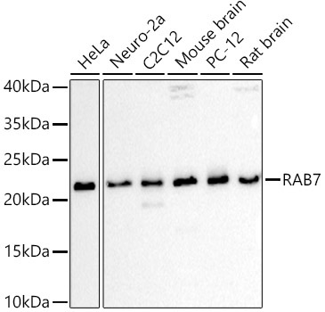 RAB7 Rabbit Polyclonal Antibody