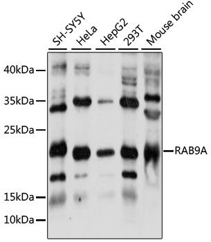 RAB9A Rabbit Polyclonal Antibody