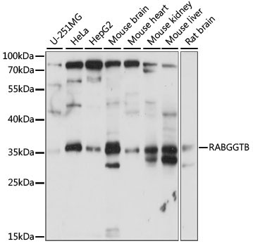 RABGGTB Rabbit Polyclonal Antibody