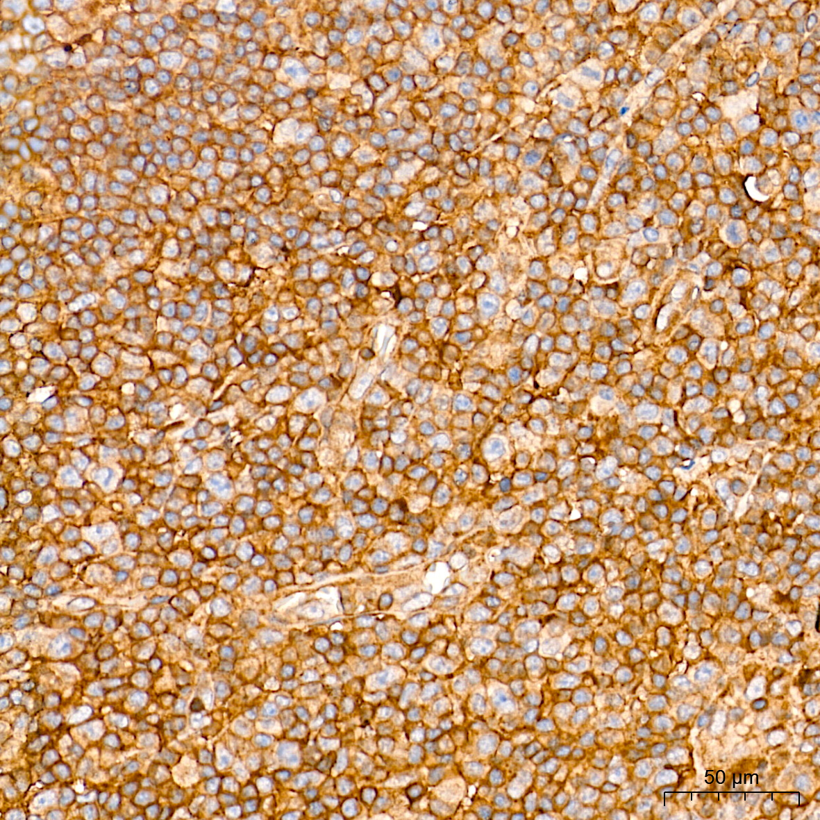 Rac1/2/3 Rabbit Monoclonal Antibody - Image 3