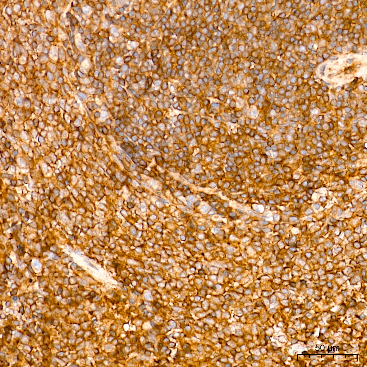 Rac1/2/3 Rabbit Monoclonal Antibody - Image 4