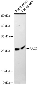 RAC2 Rabbit Polyclonal Antibody