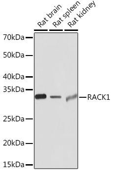 RACK1 Rabbit Monoclonal Antibody - Image 2