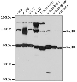Rad18 Rabbit Monoclonal Antibody