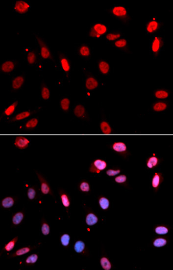 Rad18 Rabbit Polyclonal Antibody - Image 2