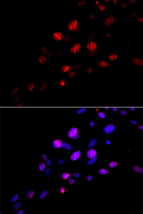 Rad18 Rabbit Polyclonal Antibody - Image 3