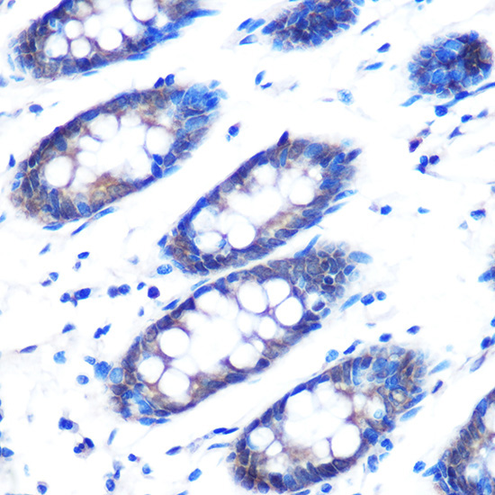Rad23B Rabbit Polyclonal Antibody - Image 2