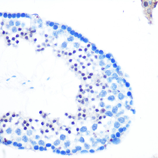 Rad23B Rabbit Polyclonal Antibody - Image 3