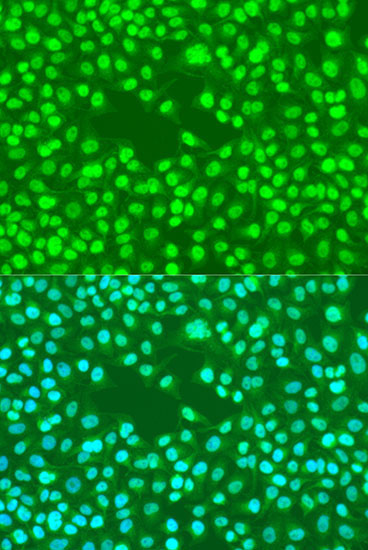 Rad23B Rabbit Polyclonal Antibody - Image 4