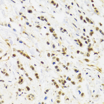 Rad50 Rabbit Polyclonal Antibody - Image 2