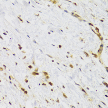 Rad50 Rabbit Polyclonal Antibody - Image 3