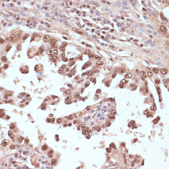 Rad50 Rabbit Polyclonal Antibody - Image 3