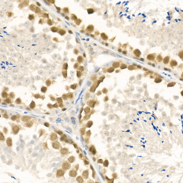 Rad51 Rabbit Polyclonal Antibody - Image 3
