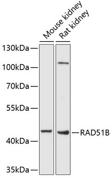 RAD51B Rabbit Polyclonal Antibody