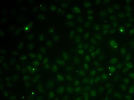 RAD51C Rabbit Polyclonal Antibody