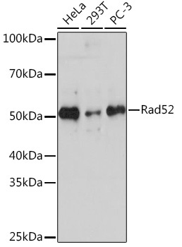 Rad52 Rabbit Monoclonal Antibody