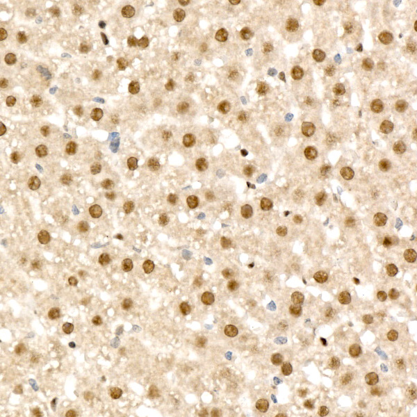 RAD54L2 Rabbit Polyclonal Antibody