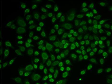 RAD54L2 Rabbit Polyclonal Antibody - Image 2
