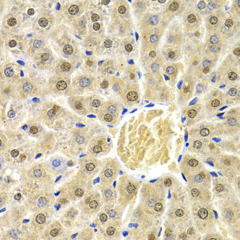 RAD9A Rabbit Polyclonal Antibody - Image 2