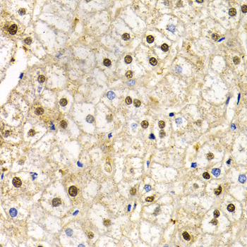 RAD9A Rabbit Polyclonal Antibody - Image 3