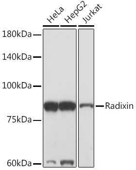 Radixin Rabbit Monoclonal Antibody - Image 2
