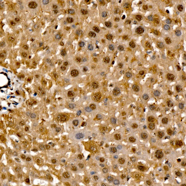 Raf1 Rabbit Polyclonal Antibody - Image 3
