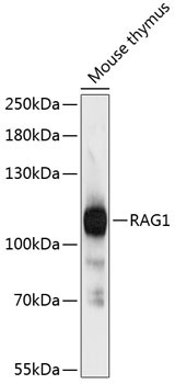 RAG1 Rabbit Polyclonal Antibody