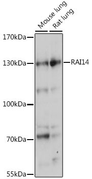 RAI14 Rabbit Polyclonal Antibody