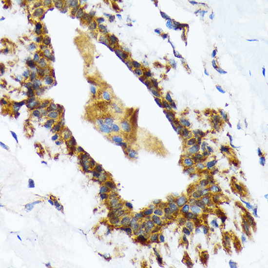 RAIDD/CRADD Rabbit Monoclonal Antibody - Image 2