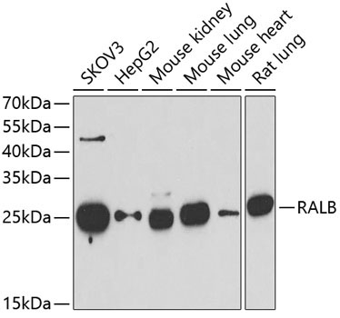 RALB Rabbit Polyclonal Antibody