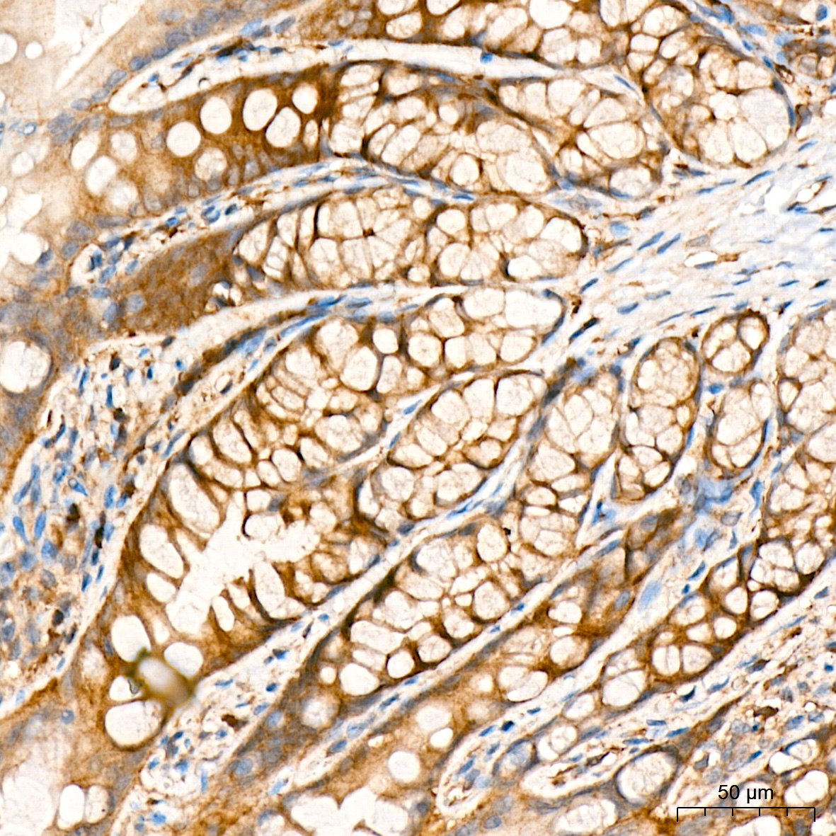RALBP1 Rabbit Monoclonal Antibody