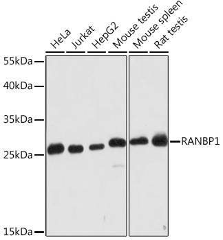 RANBP1 Rabbit Polyclonal Antibody