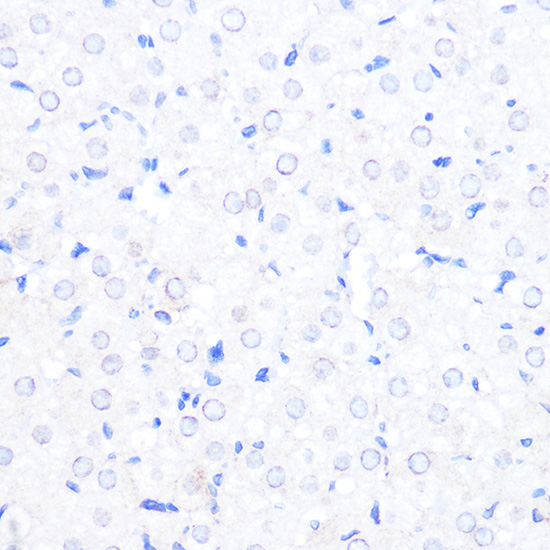 RANBP2 Rabbit Polyclonal Antibody