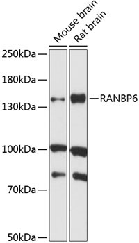 RANBP6 Rabbit Polyclonal Antibody