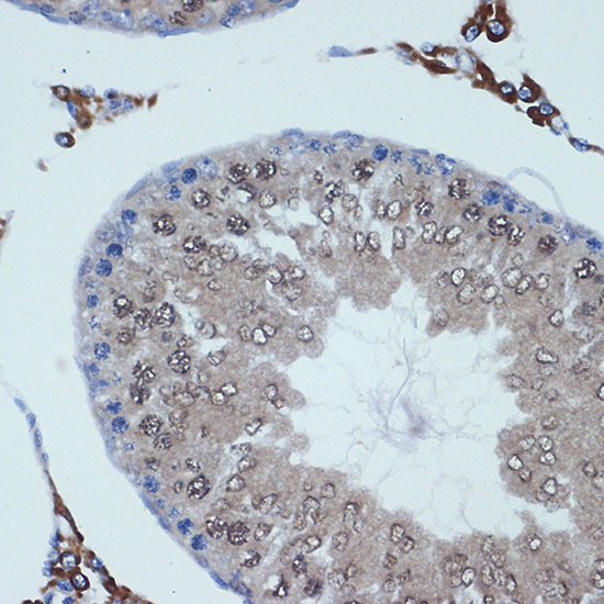 RanBP9 Rabbit Monoclonal Antibody - Image 2