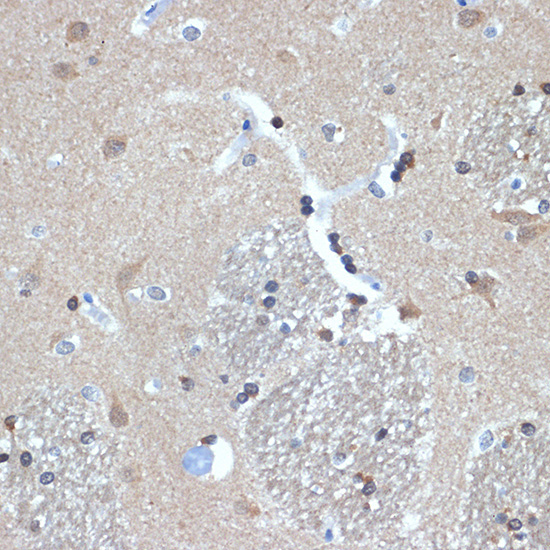 RanBP9 Rabbit Monoclonal Antibody - Image 3