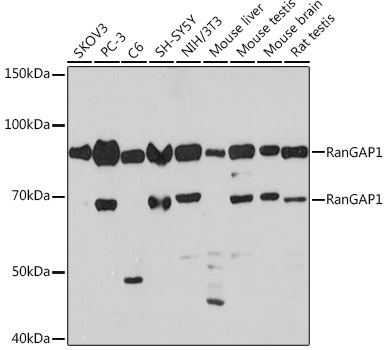 RanGAP1 Rabbit Monoclonal Antibody