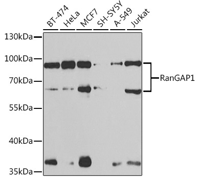 RanGAP1 Rabbit Polyclonal Antibody