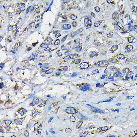 RanGAP1 Rabbit Polyclonal Antibody - Image 2