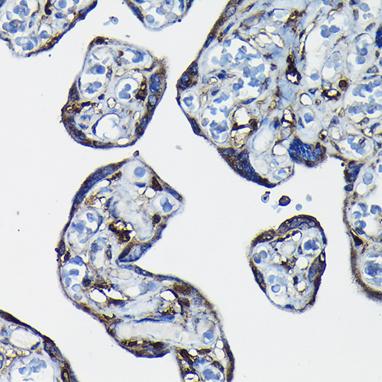 RanGAP1 Rabbit Polyclonal Antibody - Image 3