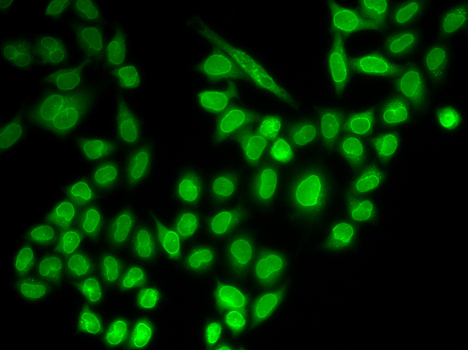RanGAP1 Rabbit Polyclonal Antibody - Image 4